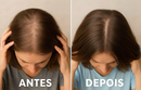 Bellease - Cabelo Forte, Pele Radiante e Unhas Resistentes em 30 Dias