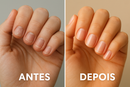 Bellease - Cabelo Forte, Pele Radiante e Unhas Resistentes em 30 Dias